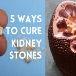 Remove Kidney Stones
