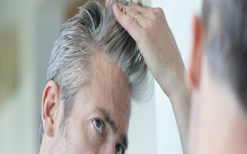 Treating Hair Loss